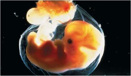 6 week fetus Pictures, Images and Photos