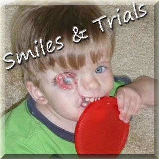 Smiles & Trials